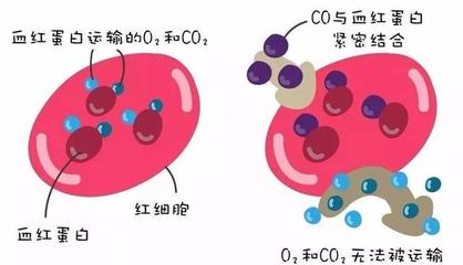 警惕洗澡季隱形殺手 一氧化碳中毒康復后，當心遲發性腦病
